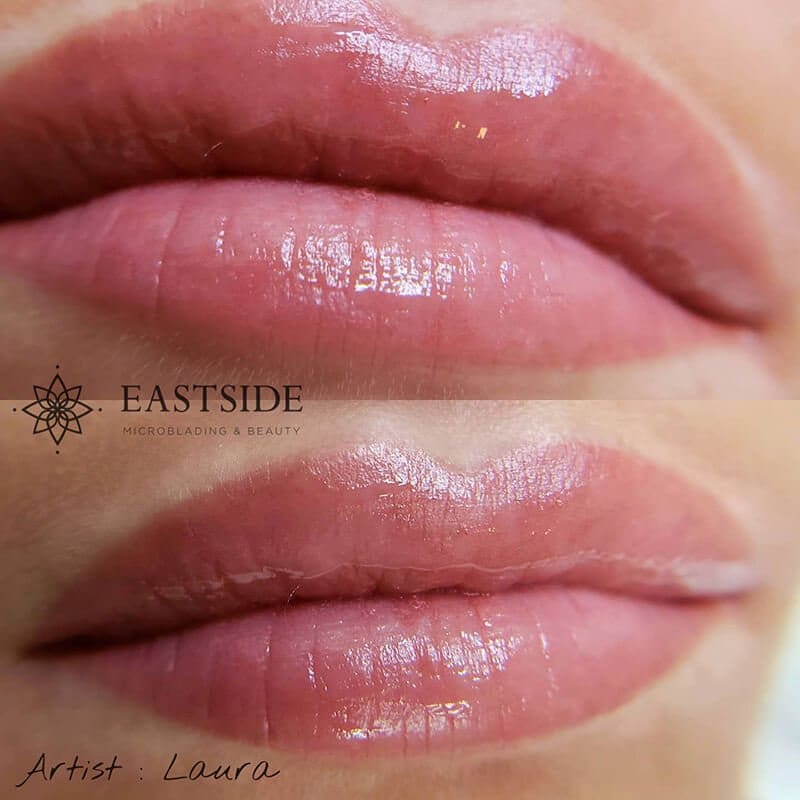 lips bellevue